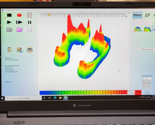 Grafische Darstellung der Fußdruckverteilung